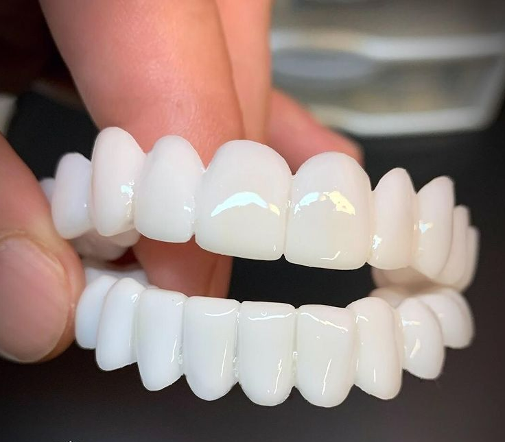 Dental Prosthesis for Comfortable and Natural Smile Restoration-Orizon Depot